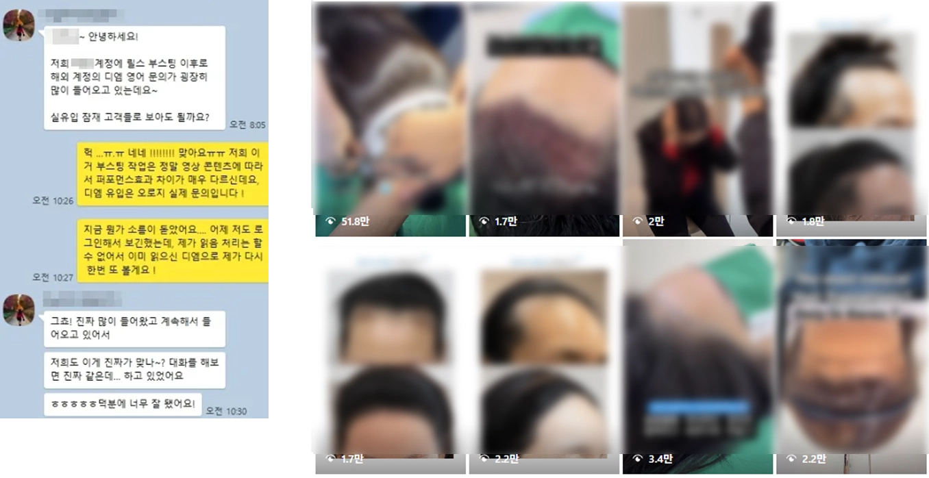 릴스 알고리즘 부스팅 실제 고객 사례 — 모발이식 계정, 조회수 51.8만, 국내 DM 문의 증가 카톡 후기